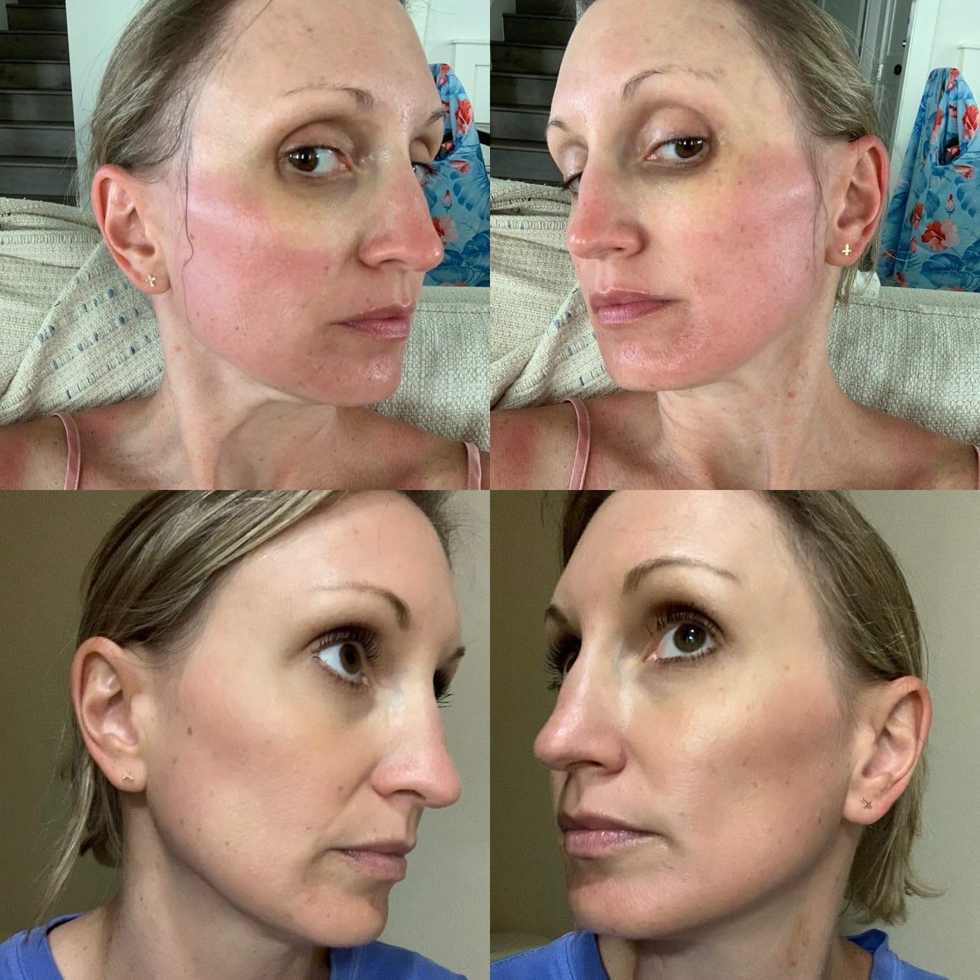 COSRX Advanced Snail 96 Mucin Power Essence 100ml