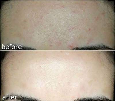 [COSRX] Advanced Snail 96 Mucin Power Essence — El Secreto Coreano para un Brillo Natural y Piel de Cristal